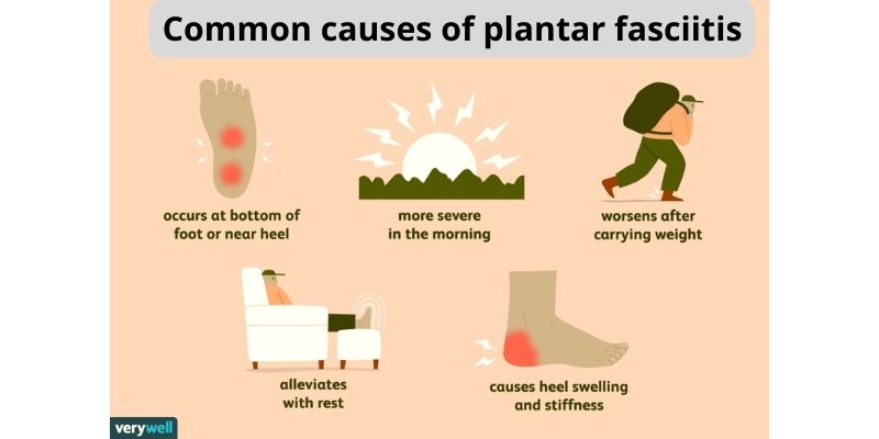 Common causes of plantar fasciitis
